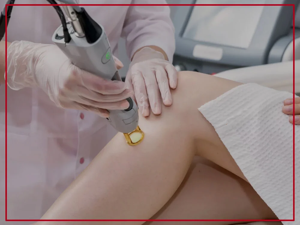 Numbing Cream for Laser Hair Removal